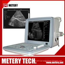 Ultraschall-Scan-Maschine